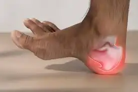 plantar fasciitis at Muscle Restoration Therapy in Fort Collins